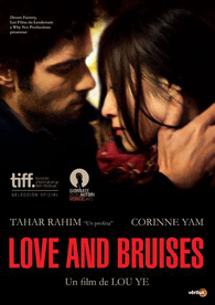 Love and Bruises